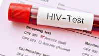 21 са новите случаи на ХИВ във Варненско за година