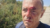 Бивш министър се претрепа с колело заради дупка на пътя (ВИДЕО)